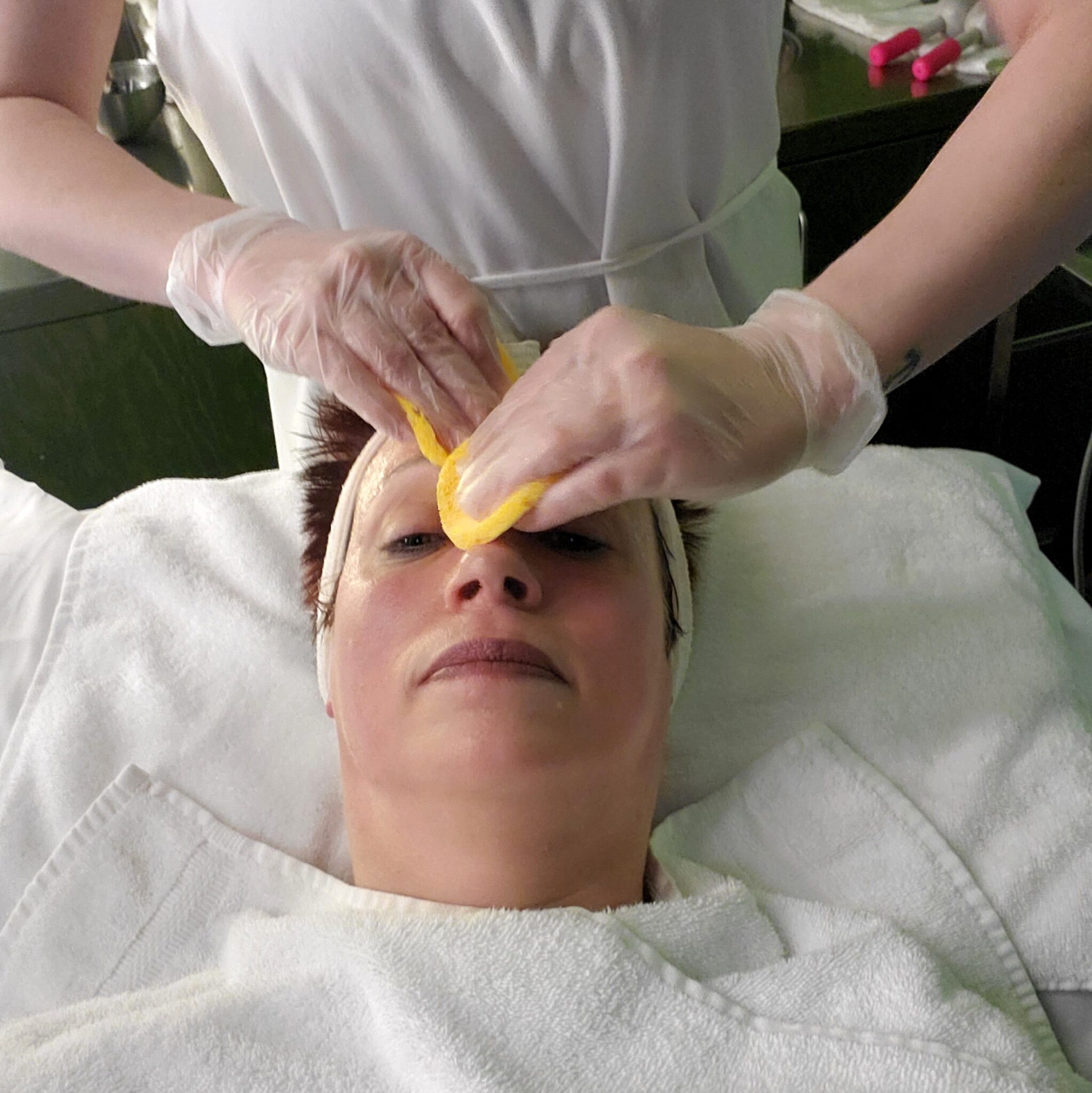 formula fig, fig facial, main street, fraxel laser, beauty treatment, vegan, crueltyfree, helen siwak, vancouver, bc, vancity